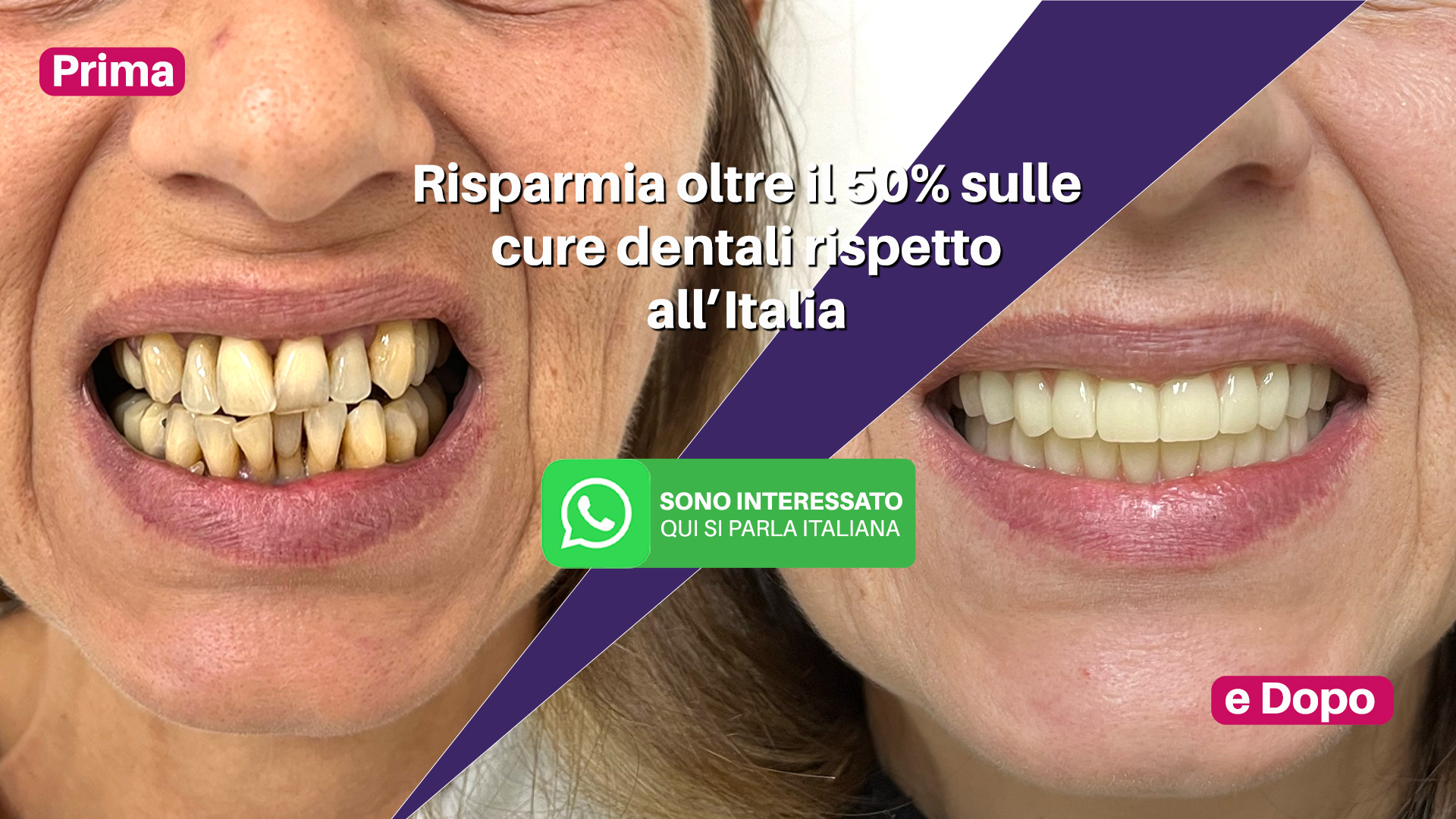 Risparmia oltre il 50% sulle cure dentali rispetto all’Italia