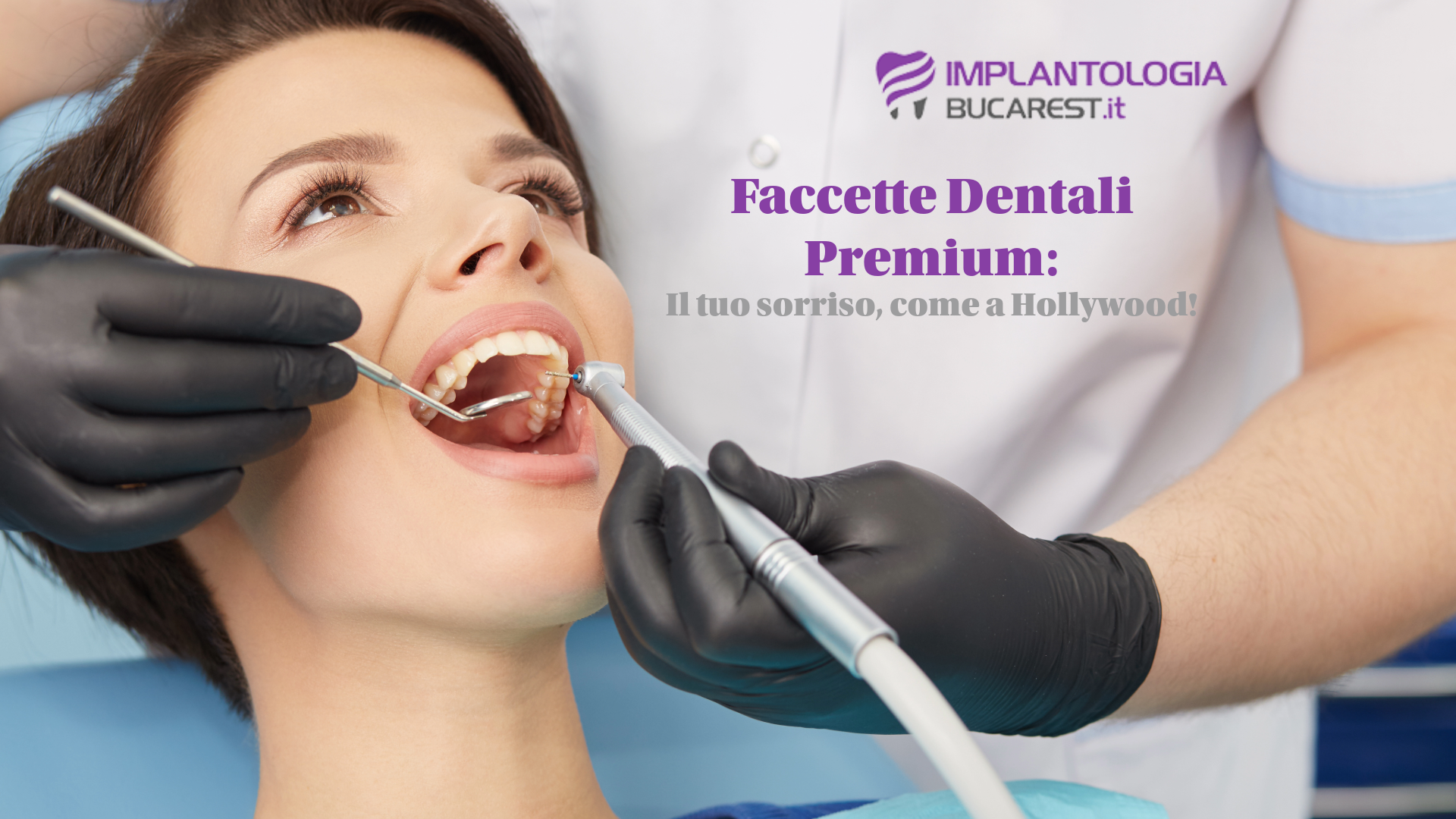 Faccette Dentali dentista romania