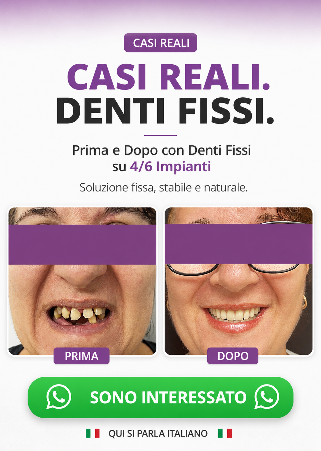 denti fissi all on 4 impianti dentali turismo dentale dentista bucarest romania 01 mnew