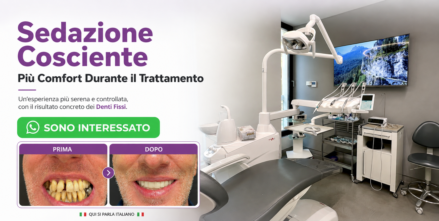 denti fissi all on 4 impianti dentali turismo dentale dentista bucarest romania 03 dnew