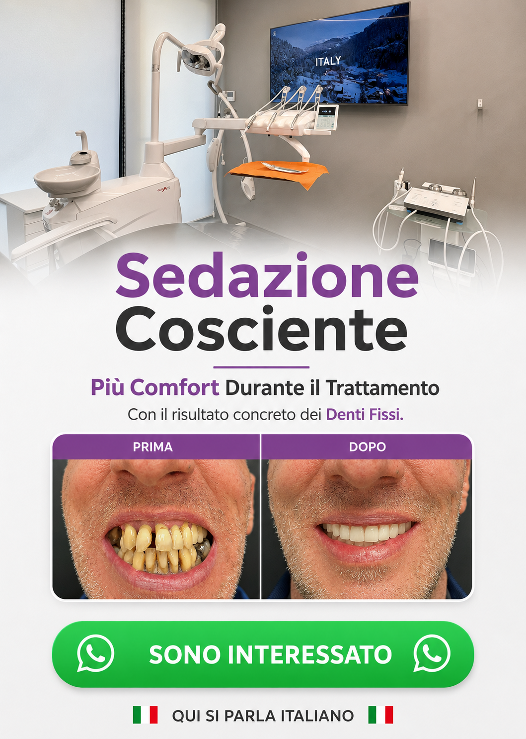 denti fissi all on 4 impianti dentali turismo dentale dentista bucarest romania 03 mnew