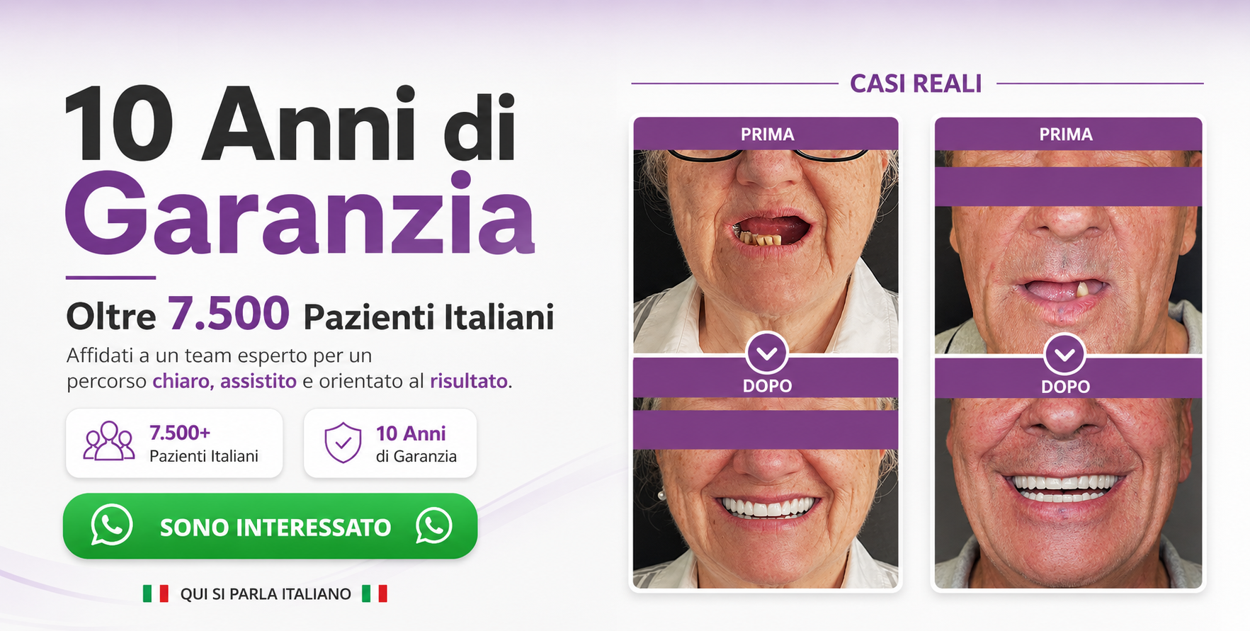 denti fissi all on 4 impianti dentali turismo dentale dentista bucarest romania 05 dnew