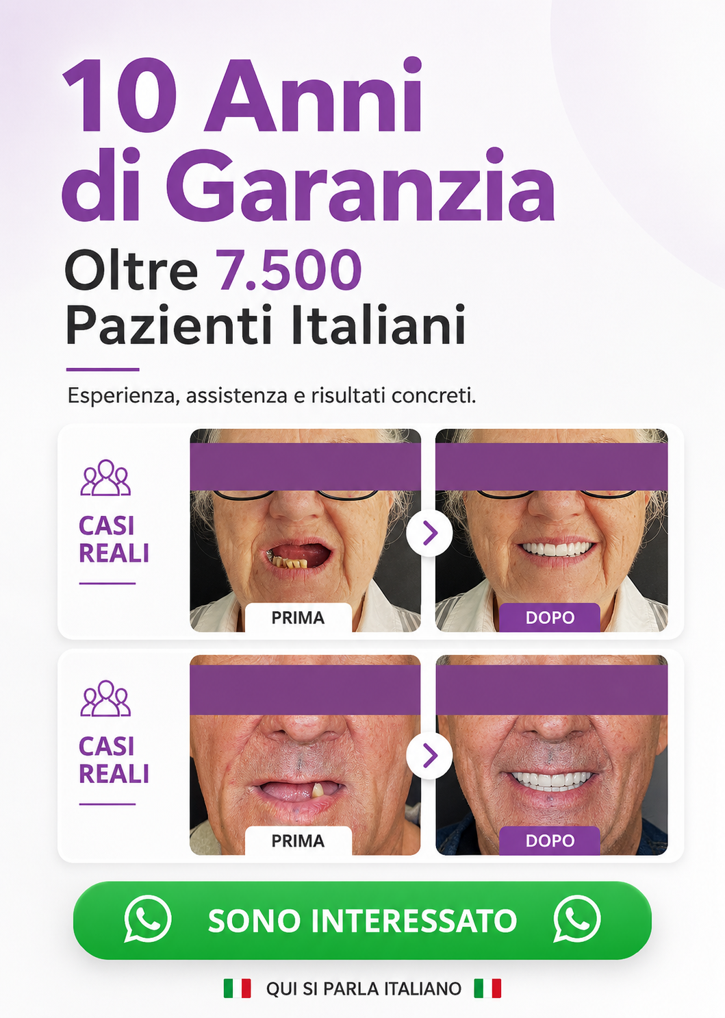 denti fissi all on 4 impianti dentali turismo dentale dentista bucarest romania 05 mnew