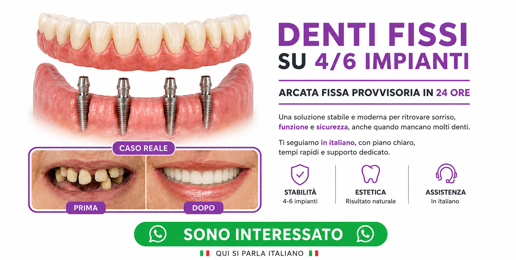 denti fissi all on 4 impianti dentali turismo dentale dentista bucarest romania B d