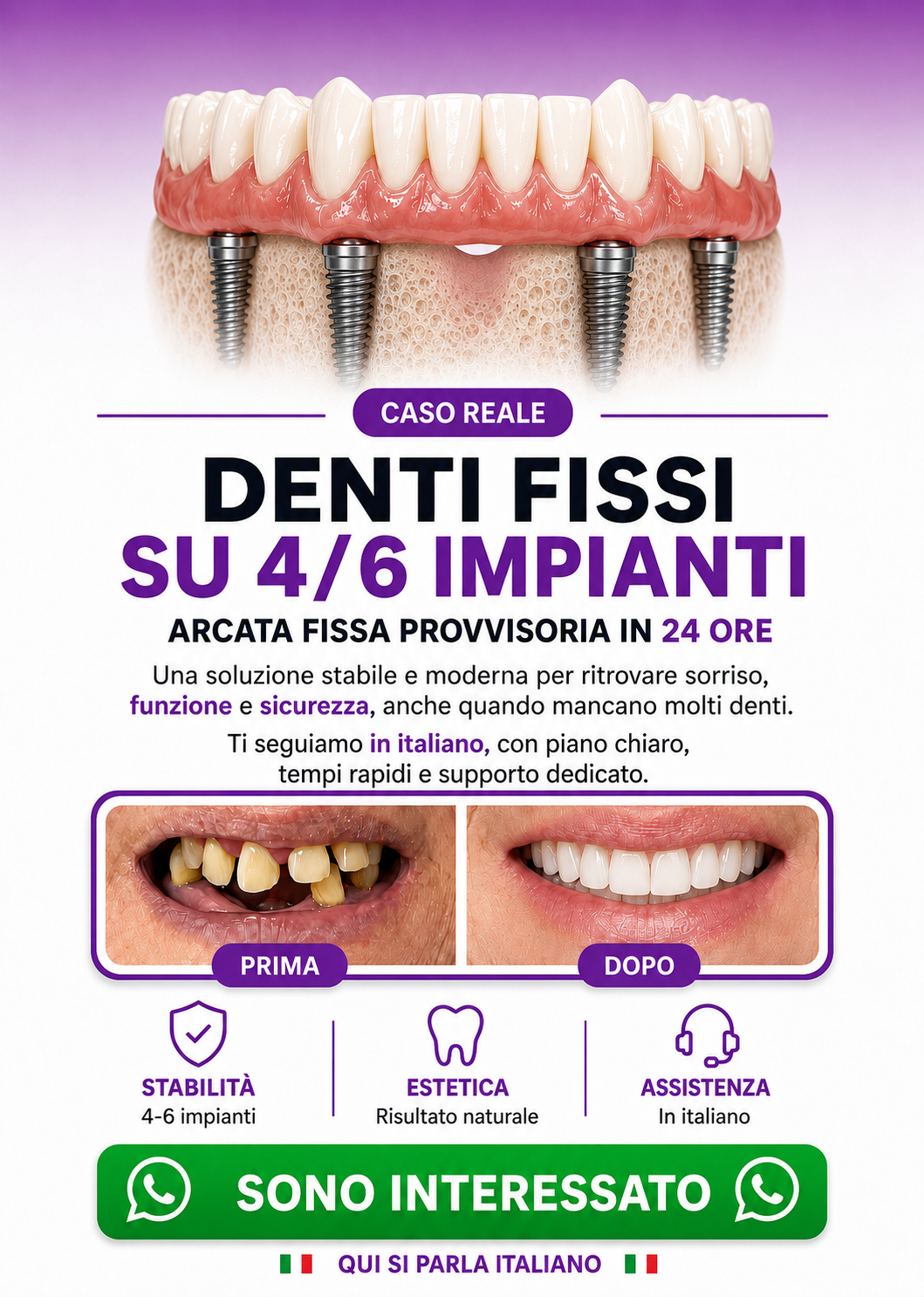 denti fissi all on 4 impianti dentali turismo dentale dentista bucarest romania B m