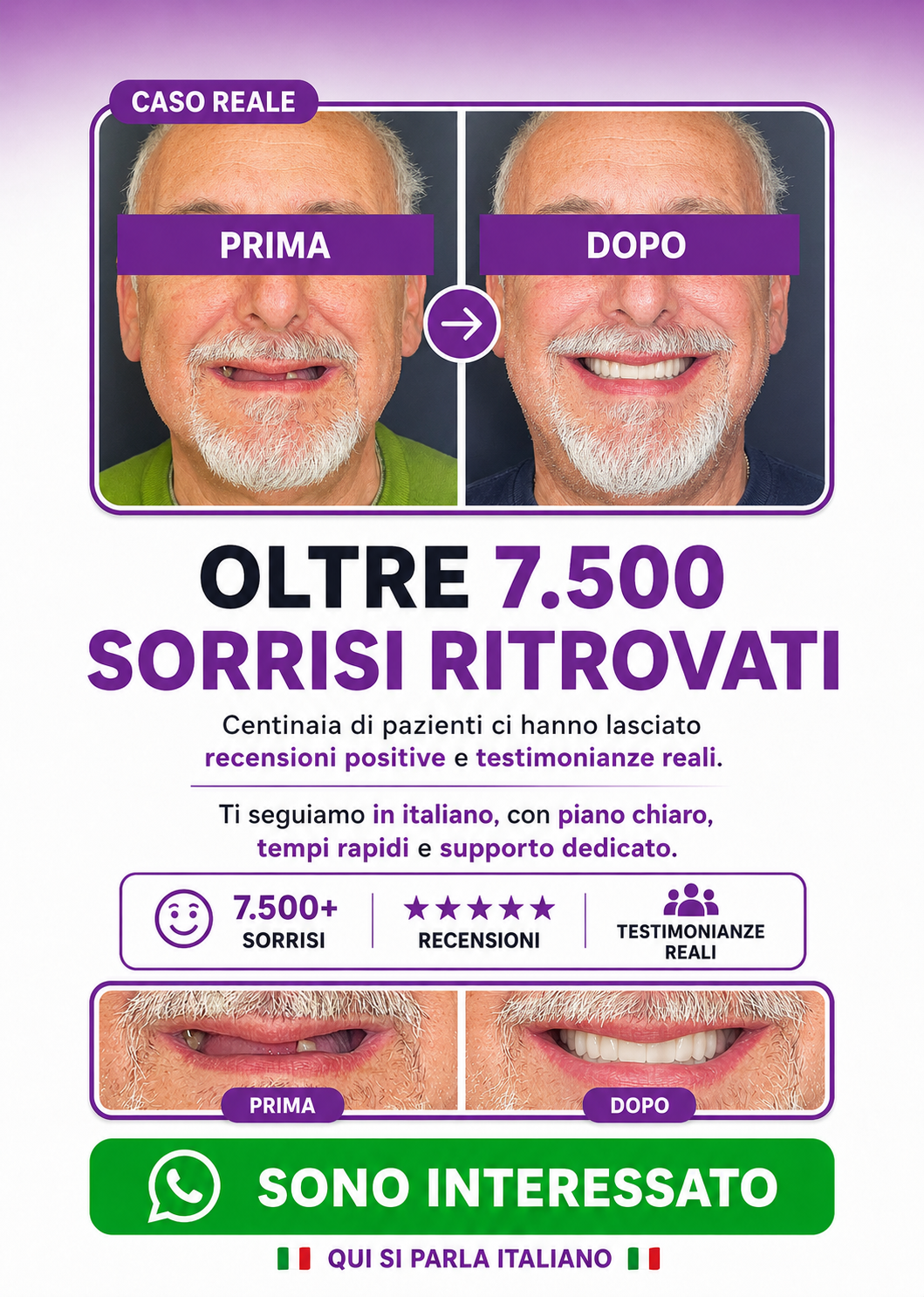 denti fissi all on 4 impianti dentali turismo dentale dentista bucarest romania D m